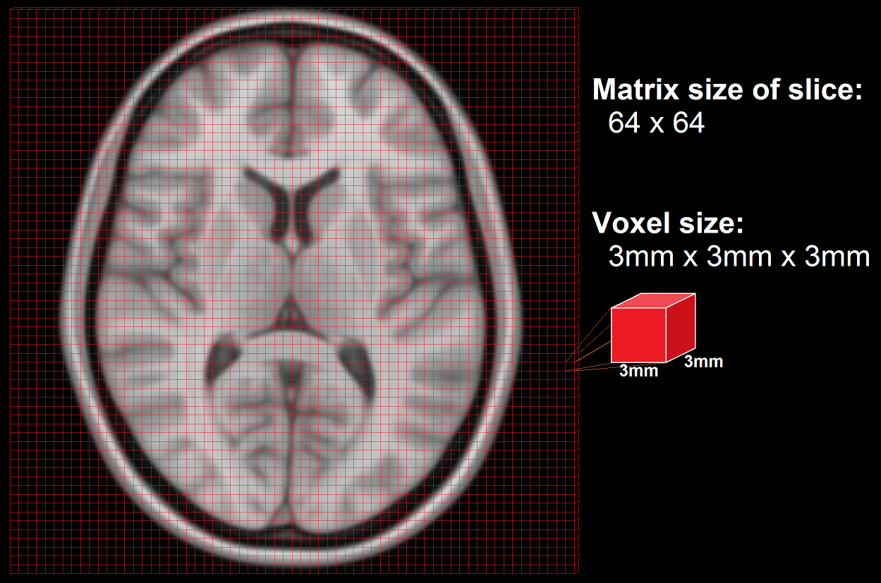 Nipype Beginner's Guide — All you need to know to an expert in