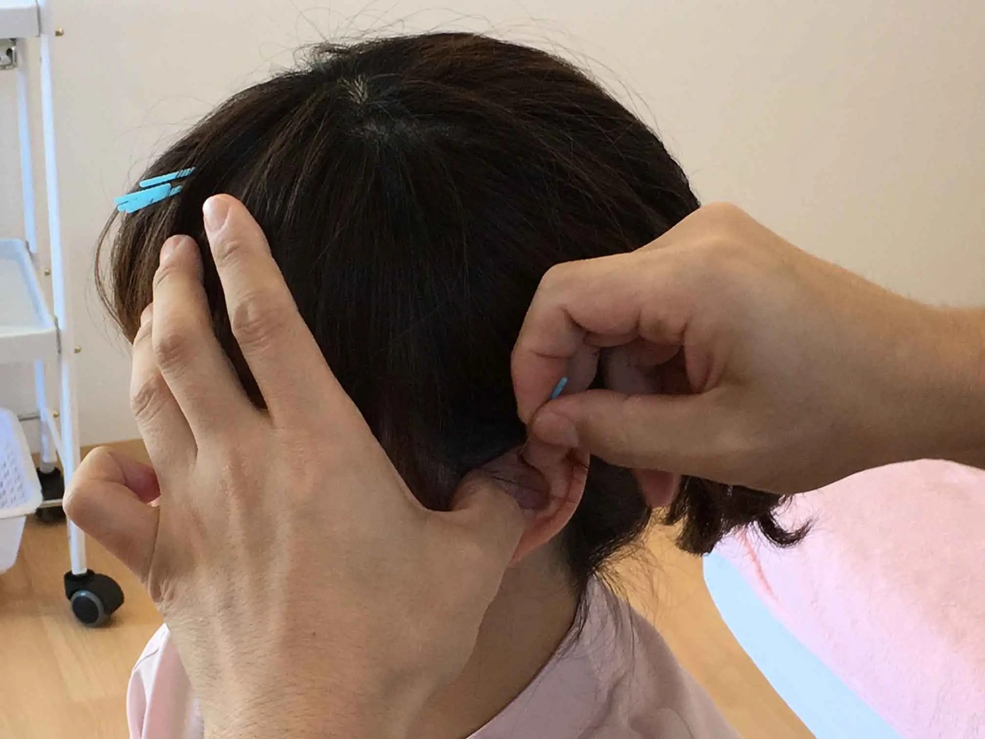 YNSA（山元式新頭針療法）浜松西部は当院だけ みぞぐち鍼灸院