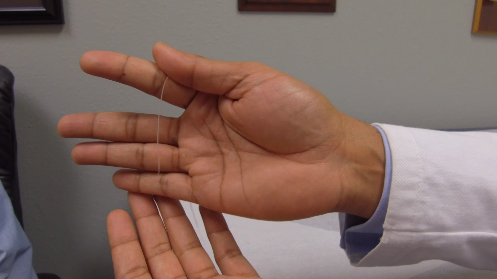 SPR Therapeutics Announces 1000th Sprint PNS Procedure