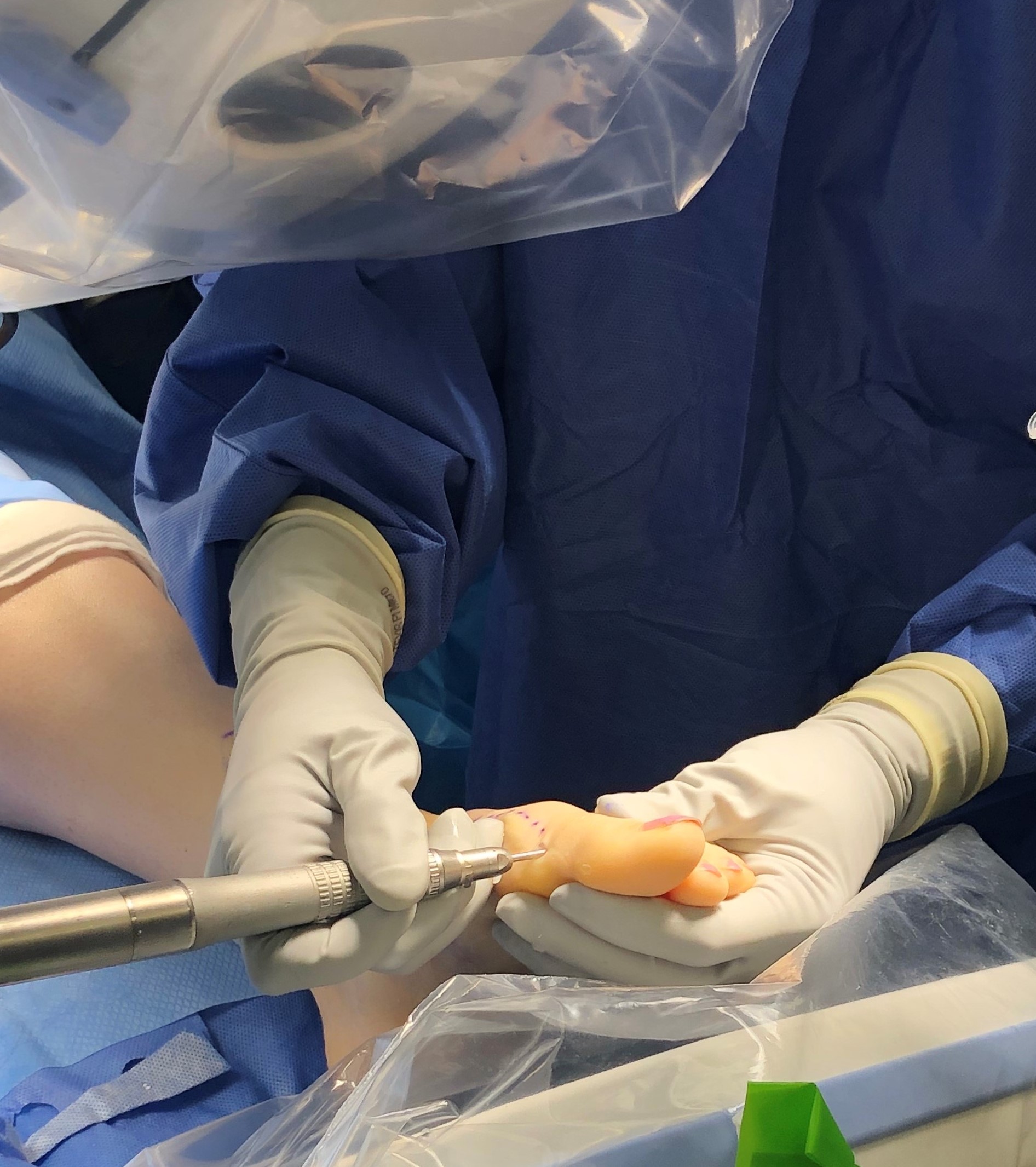 What Is Minimally Invasive Foot and Ankle Surgery?
