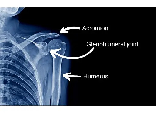The Truth about Frozen Shoulder (15 Facts You Should Know) Facts & Physio