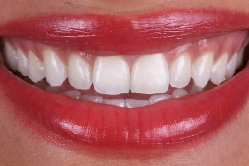 Whole Dental Design Cosmetic Dentist in Davie / Plantation FL