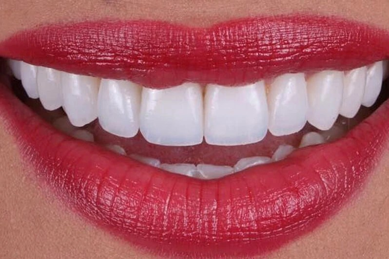 Whole Dental Design Cosmetic Dentist in Davie / Plantation FL