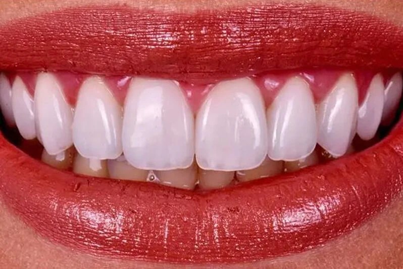 Whole Dental Design Cosmetic Dentist in Davie / Plantation FL