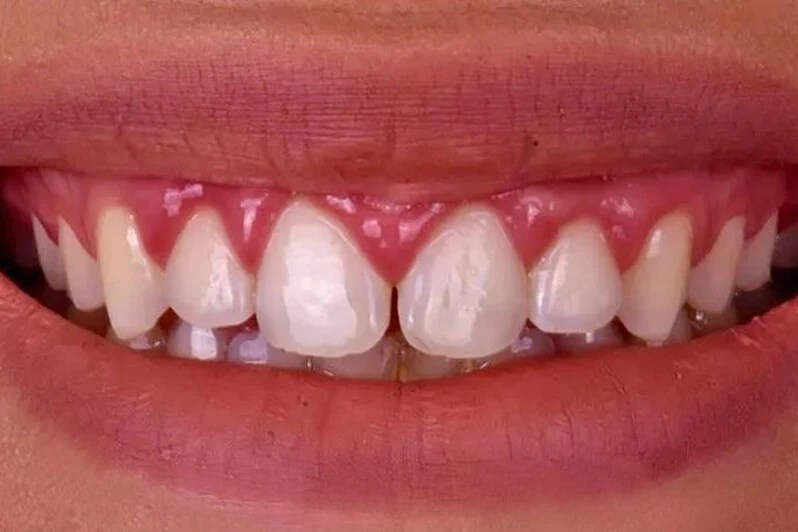 Whole Dental Design Cosmetic Dentist in Davie / Plantation FL