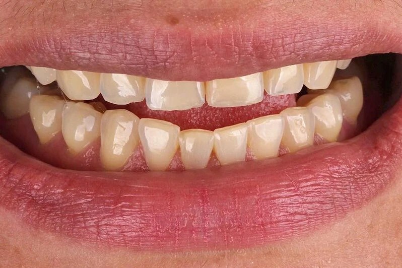 Whole Dental Design Cosmetic Dentist in Davie / Plantation FL