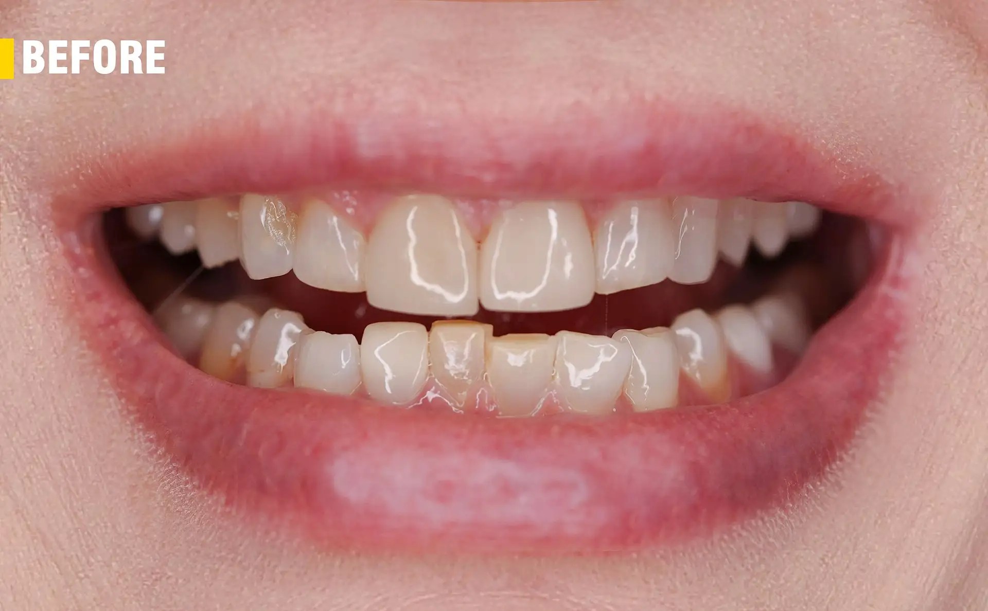 Whole Dental Design Cosmetic Dentist in Davie / Plantation FL