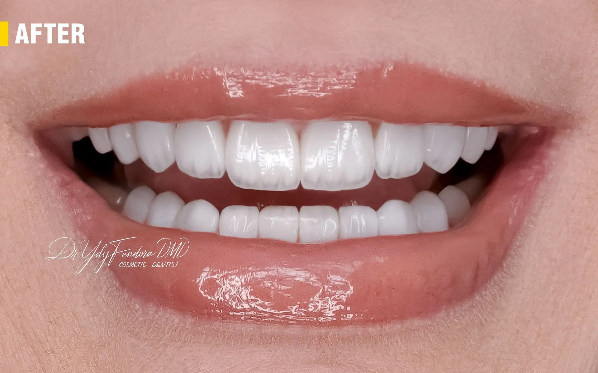 Whole Dental Design Cosmetic Dentist in Davie / Plantation FL