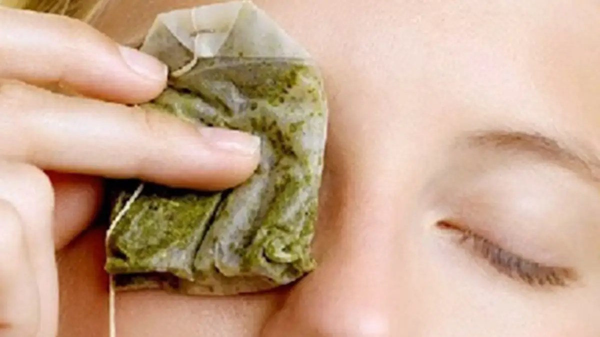 Do Tea Bags On Eyes Really Work? Dark Circles Free