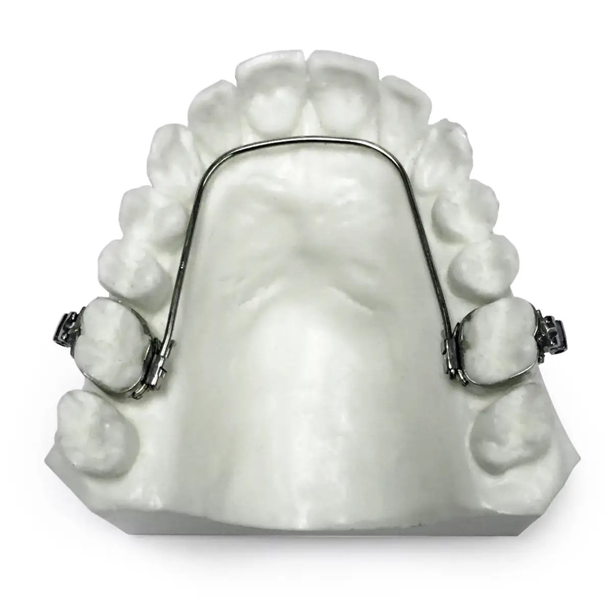 Fixed Lingual Controlled Arch Ortho Arch
