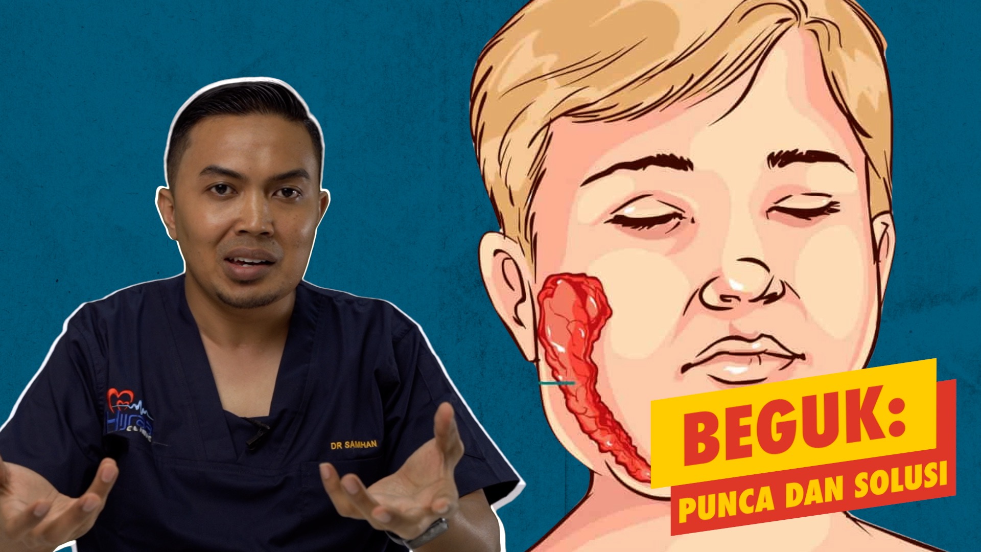 Beguk Punca dan Solusi ML Studios