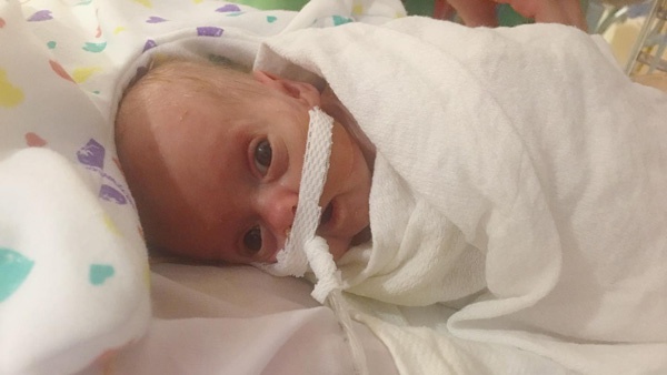 Born 17 Weeks Premature, Charleigh Is A Little Miracle With A Big