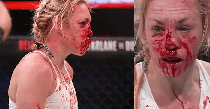 Photo Heather Hardy's Busted Up Face, Three Days After Bellator Loss MMA Imports