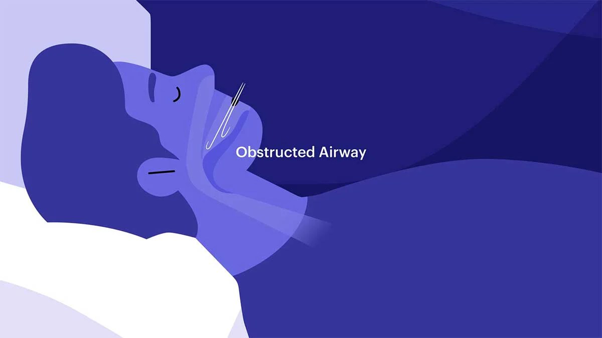 Best Mattress for Sleep Apnea Mattress & Pillows MM Foam