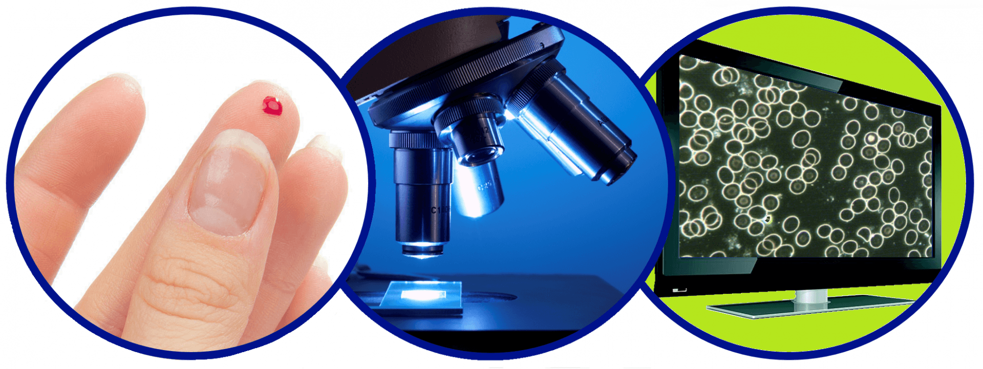 Blood Analysis Melbourne Live Blood Analysis Melbourne