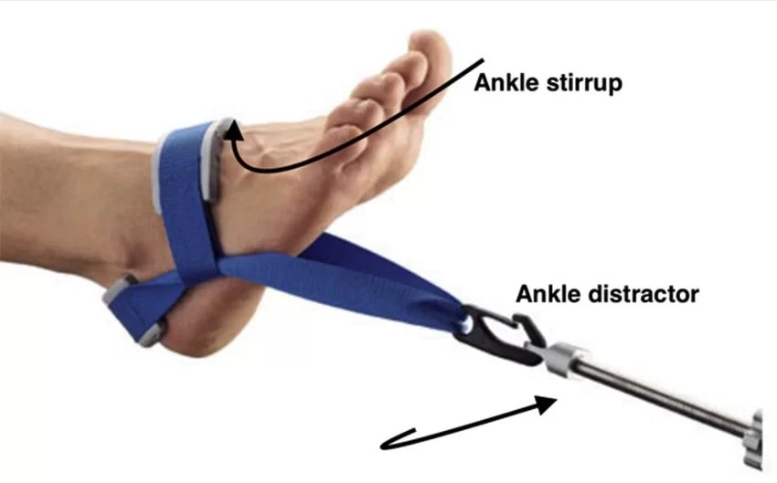 Ankle Traction Uses, Contraindications, How to take traction?