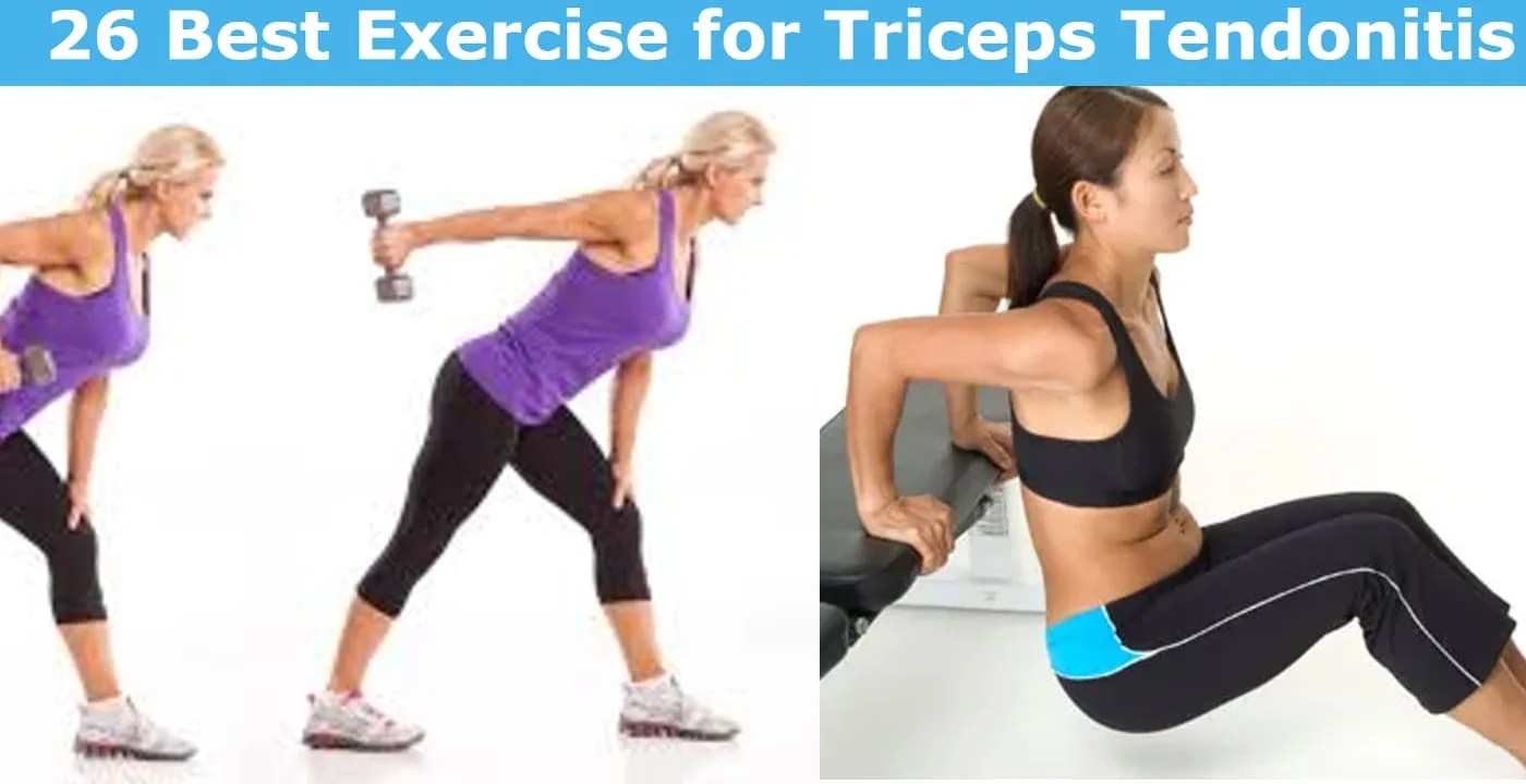 26 Best Exercise for Triceps Tendonitis Mobile Physio