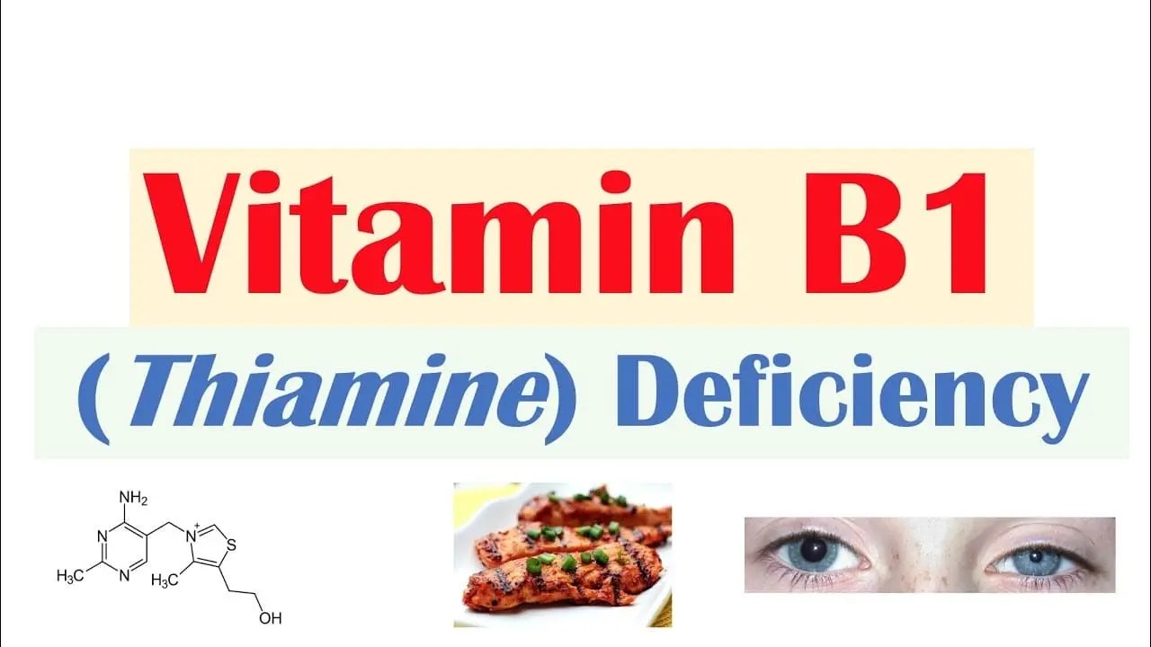 Thiamine (Vitamin B1) Deficiency Cause, Symptom, Treatment