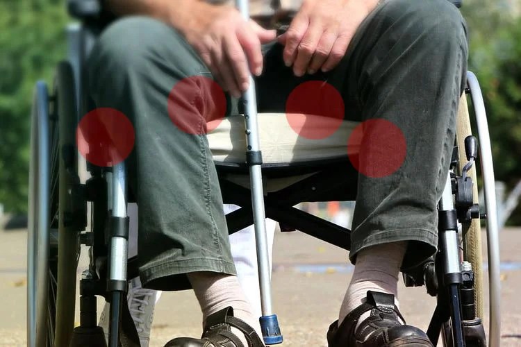 Pressure Sores In Wheelchair Users