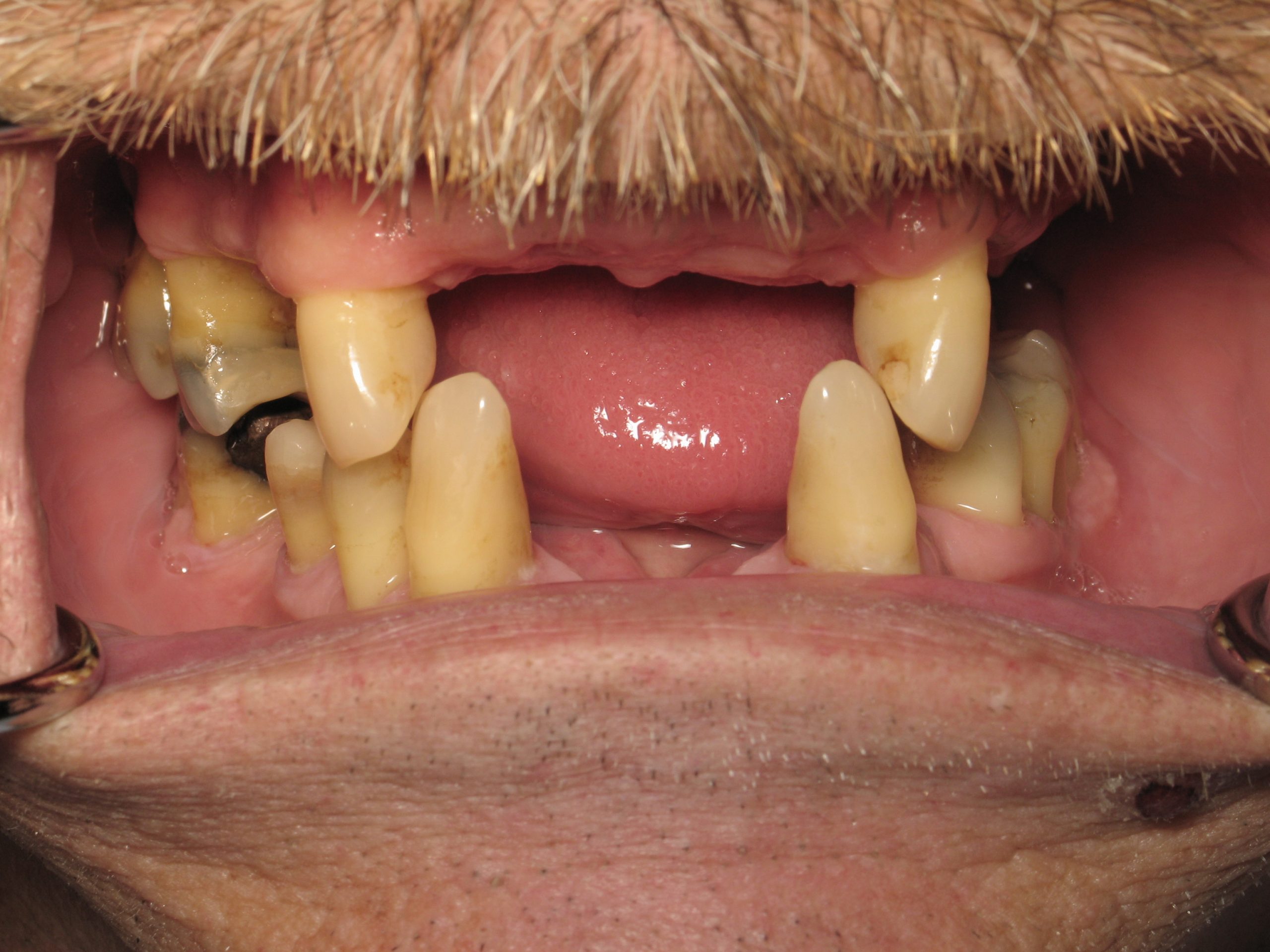 Smile Gallery Moffitt Restorative Dentistry Champlin, MN