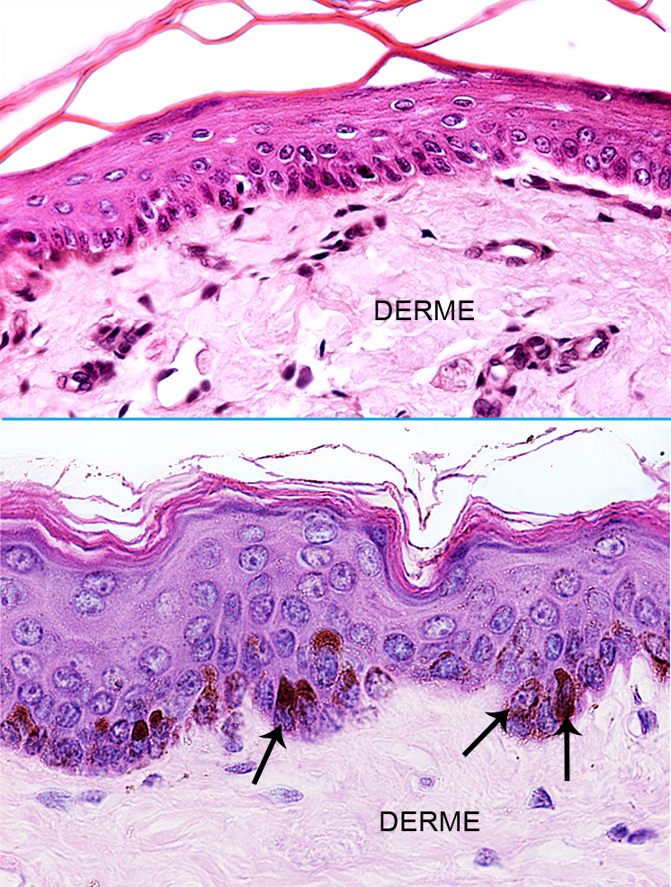 158 Pele HISTOLOGIA