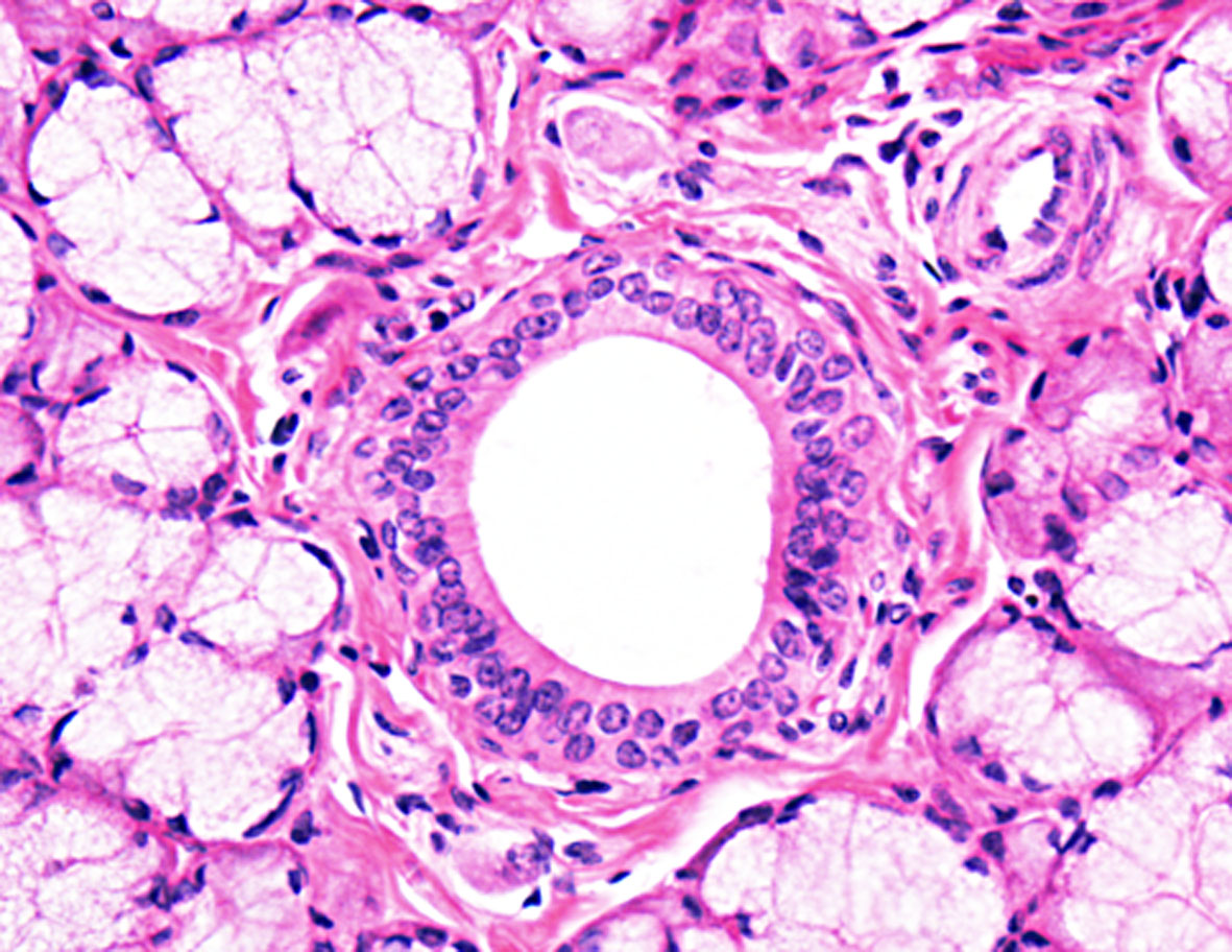 318 Tecido epitelial glandular HISTOLOGIA