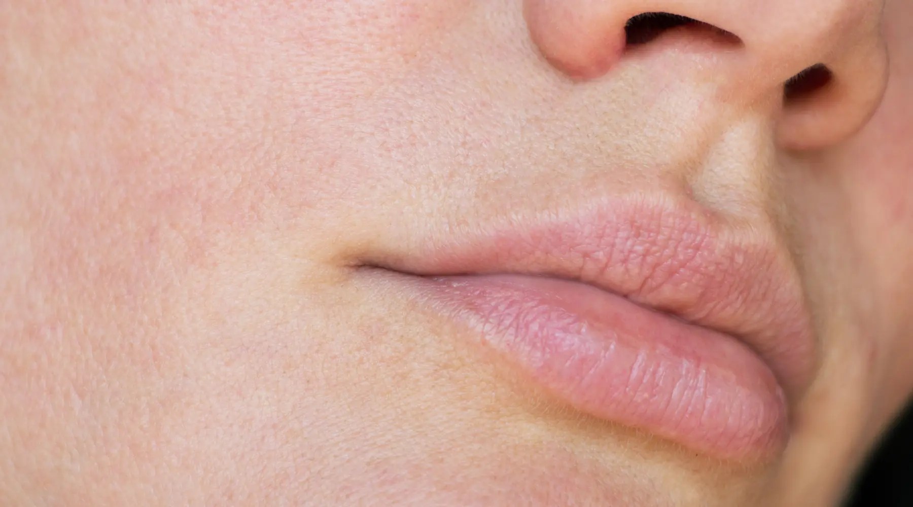 Winter Skin Wellness Tips Molekule