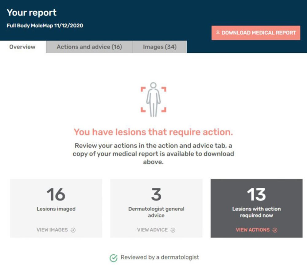 molemapwebsite MoleMap Australia