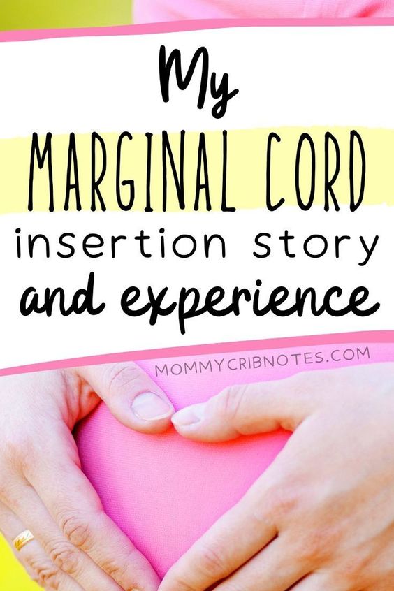 Marginal Cord Insertion One Mom's Personal Experience