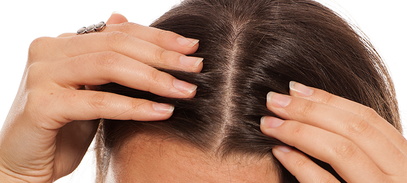 Hair Density? What’s That?