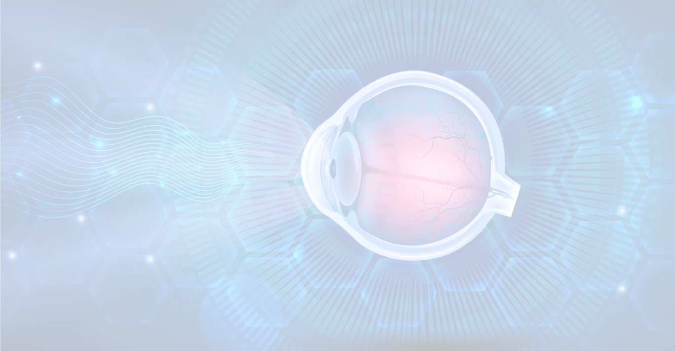 EVO ICL Vision Correction Surgery Monson Vision