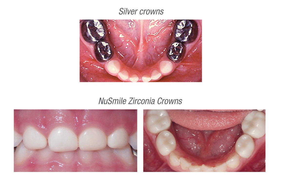 Gallery of Success Montebello Children's Dentistry