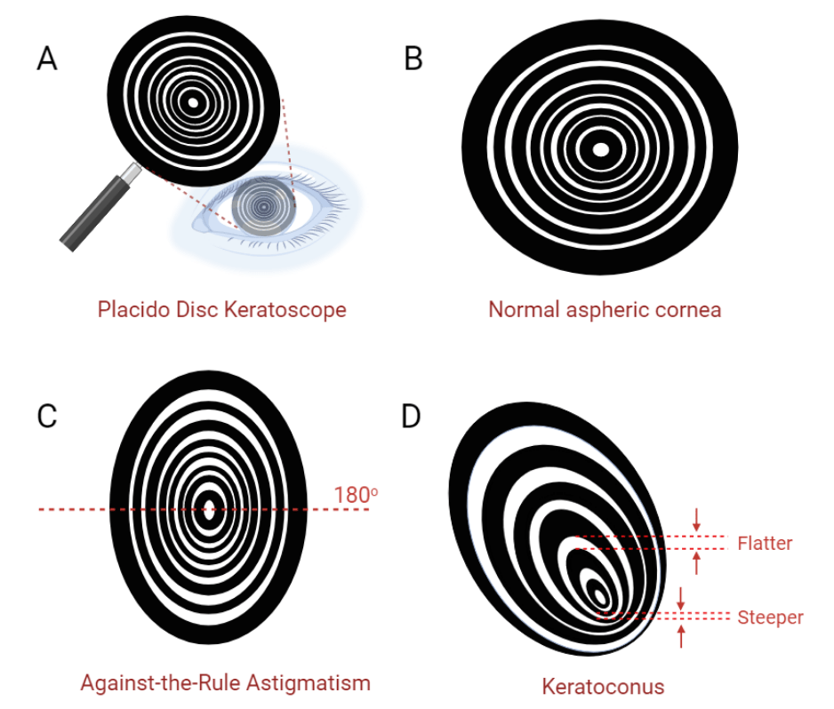 Moran CORE Essentials of Biometry (Part 2) How are biometric
