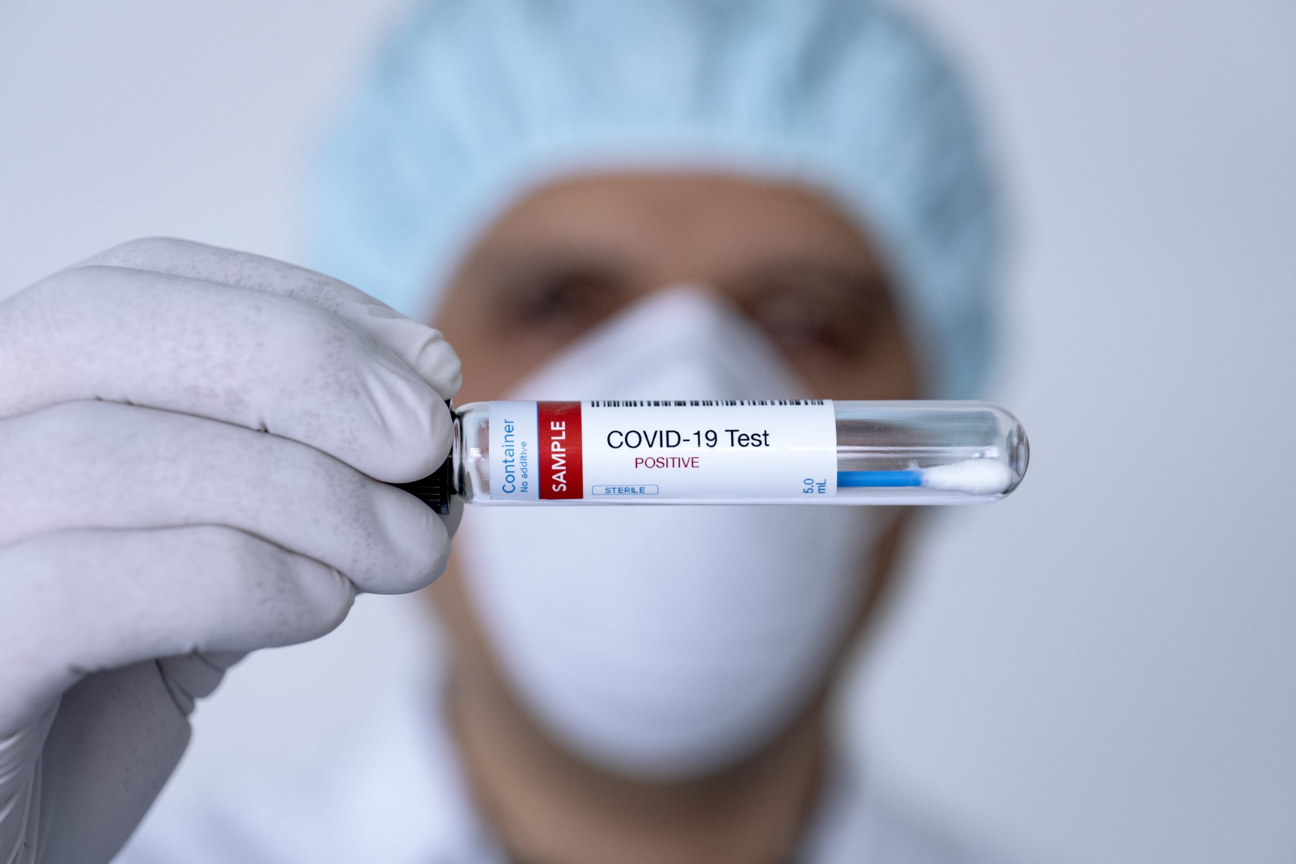 Rowan County has second confirmed positive case of COVID19 City of