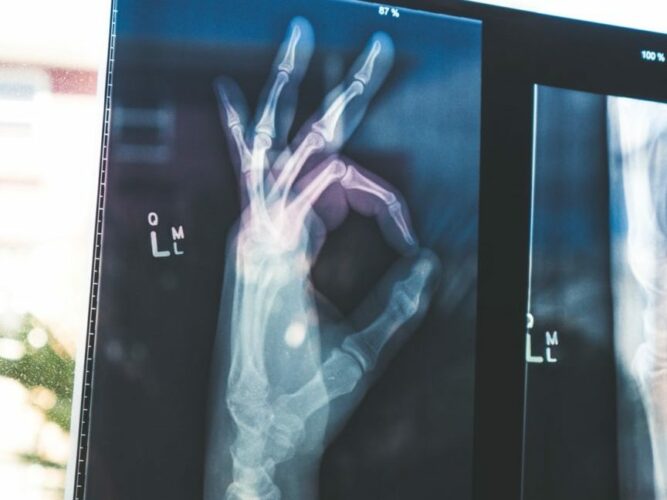 What is Critical Illness Insurance? More than Money