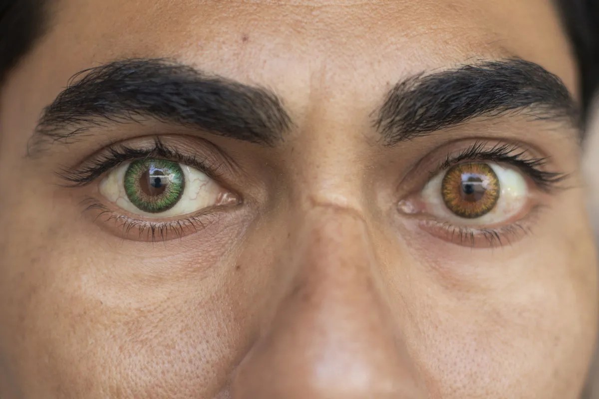 What is the rarest eye colour in the world?