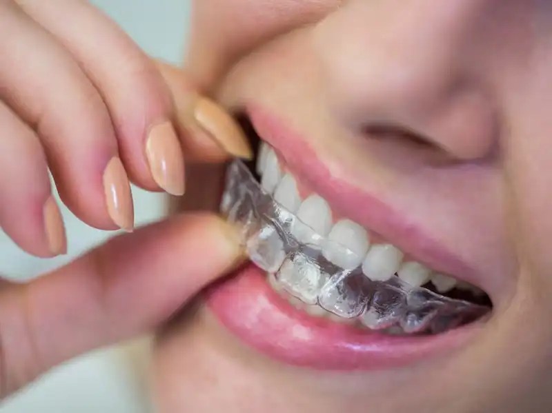 Best Dental Clinic in Ajman Dental Hospital Ajman Mother Dental Center