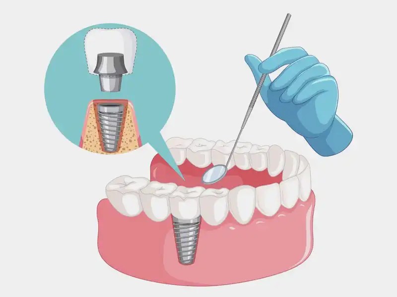 Best Dental Clinic in Ajman Dental Hospital Ajman Mother Dental Center