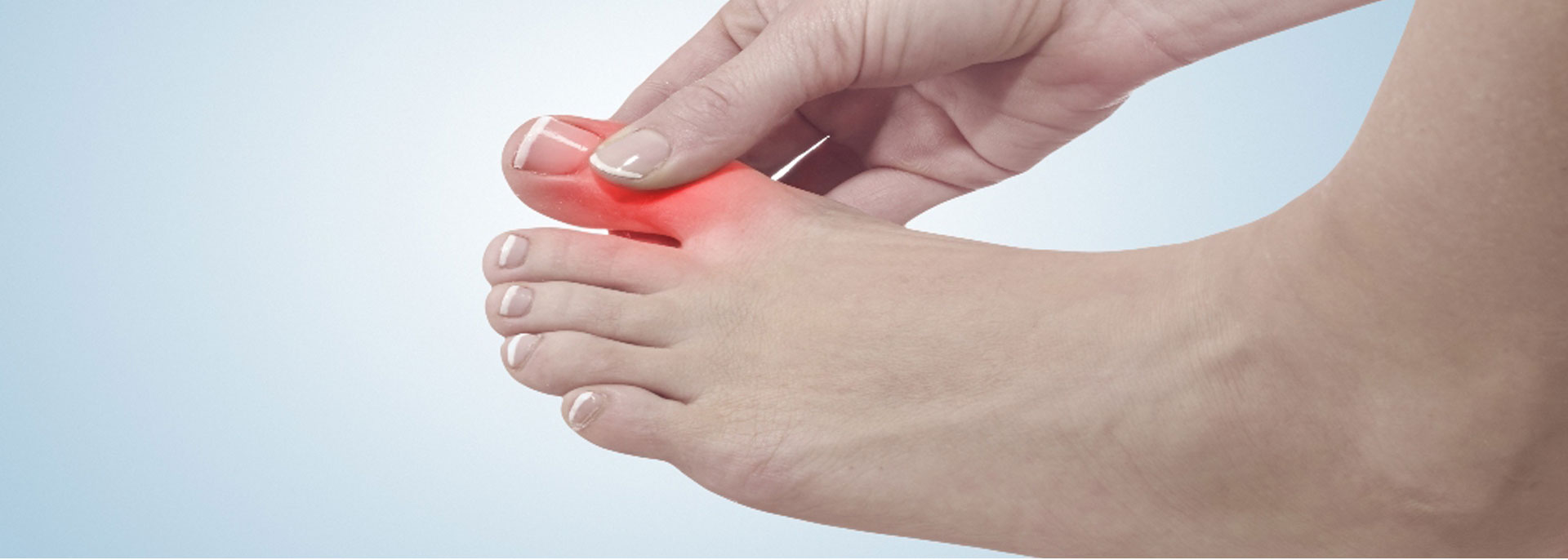 TURF TOE MOTUS Physical Therapy