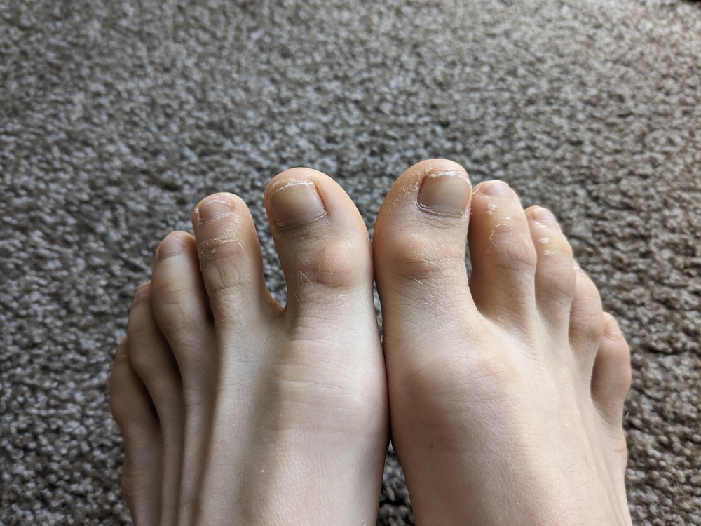 Big toe hurts bad, help me find shoes please!!!