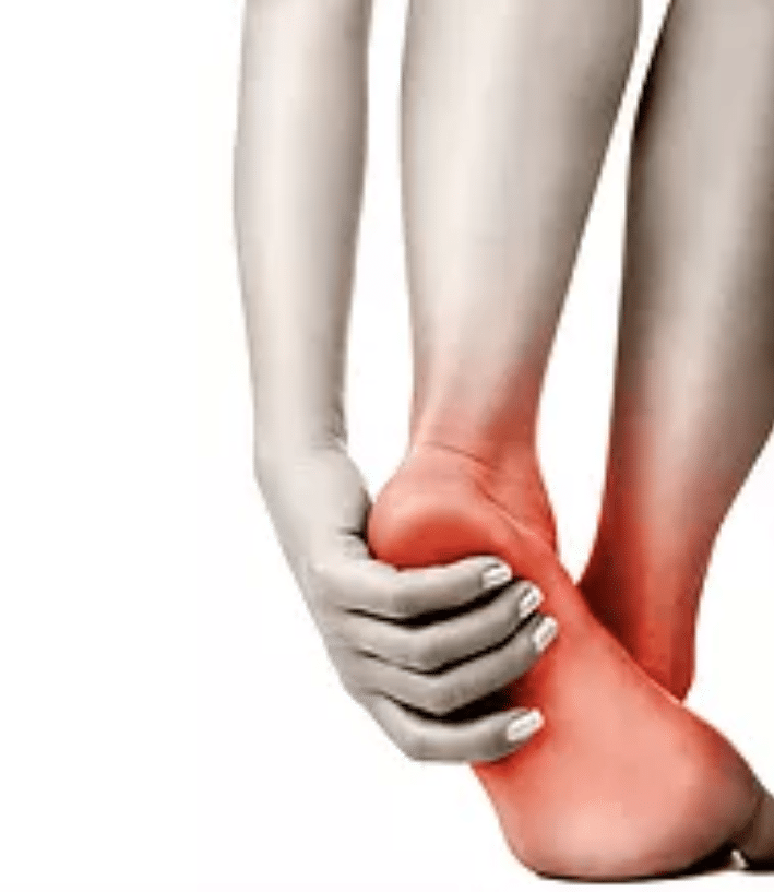 Heel Pain A guide to management Moving Forward Podiatry