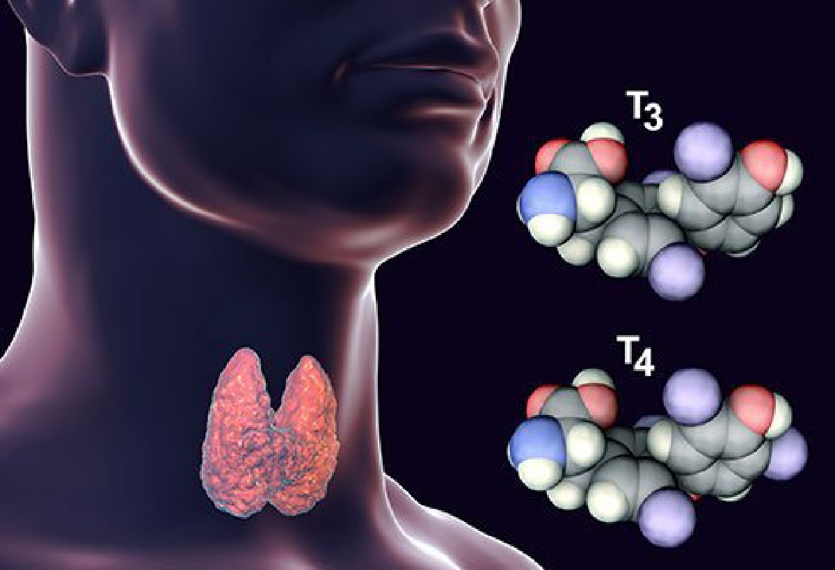 المستويات العالية من TSH