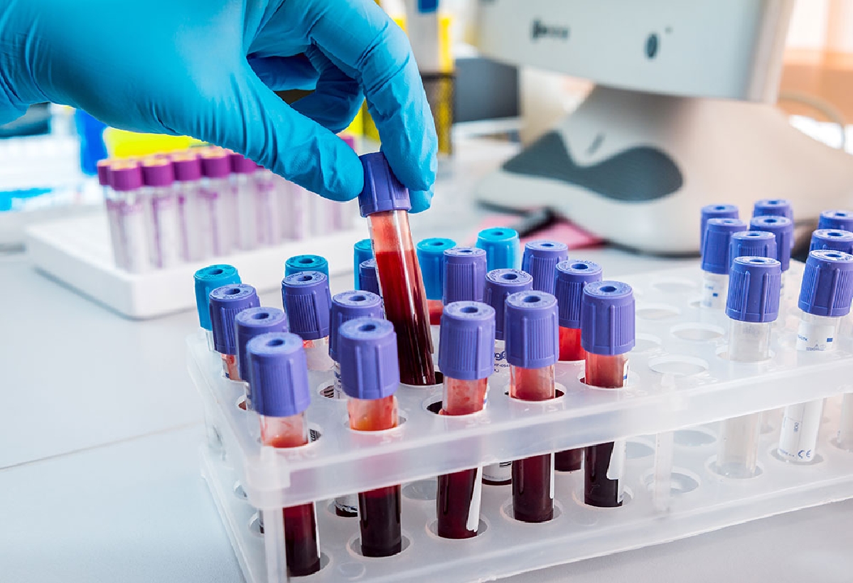 تحليل الحمل بالدم متى يضهر