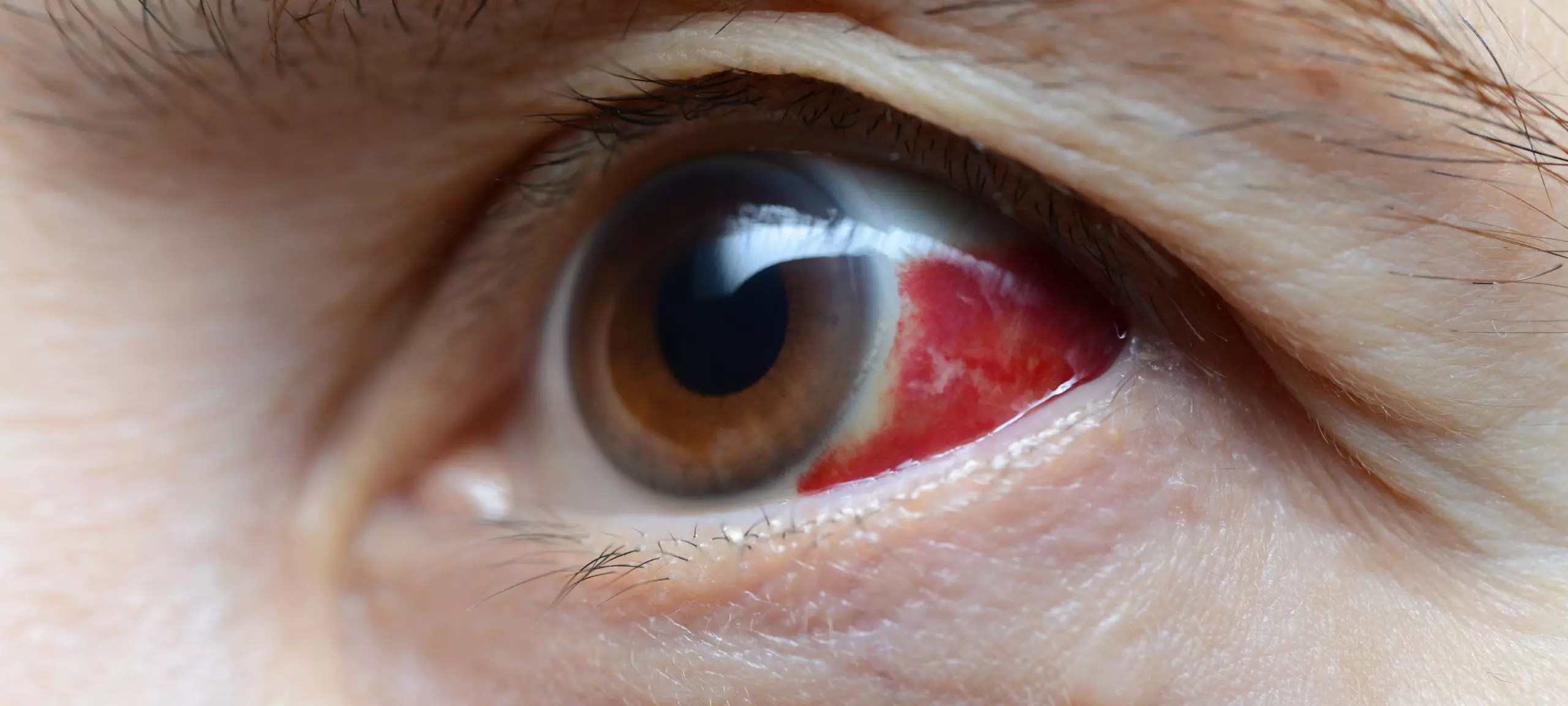 تفسير حلم رؤية رجل بعين واحدة في المنام