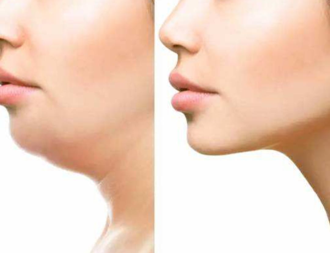 Double Chin Reducing Tips डबल चिन खराब कर रहा है चेहरे की खूबसूरती? इन