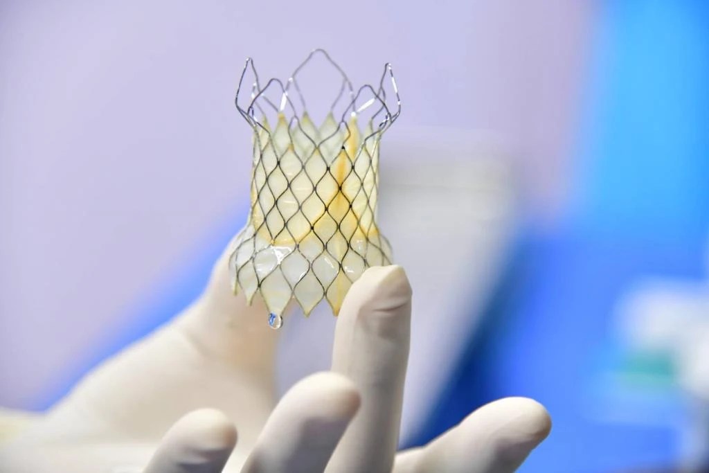 "Ministry of Public Health Opens Heart Valve Replacement Center for