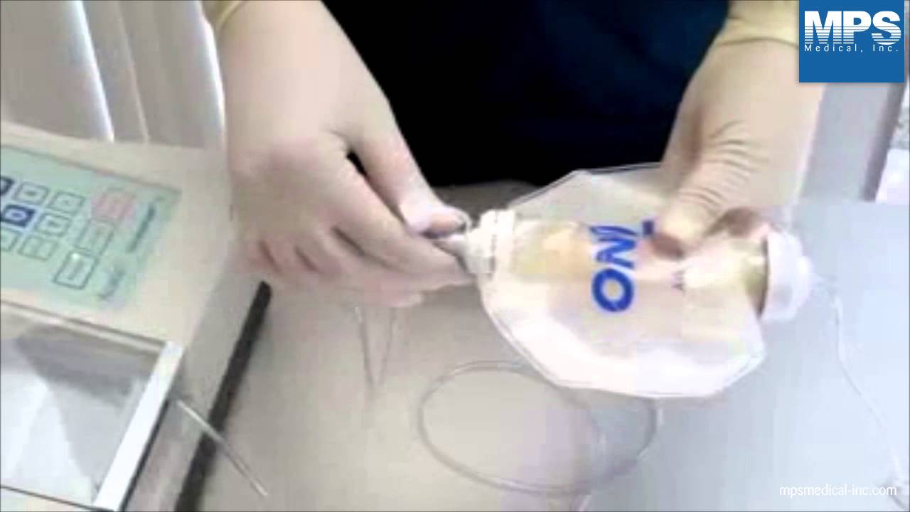 ADP3000 Pharm Pump III Calibration Video MPS Pharma & Medical, Inc.