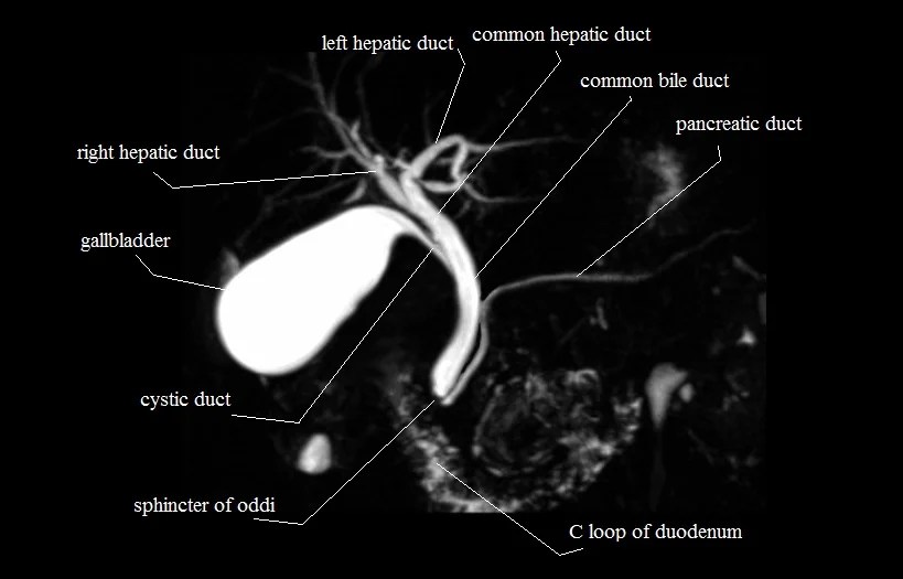 MRI MRCP Anatomy Free MRI Coronal Cross Sectional Anatomy of the