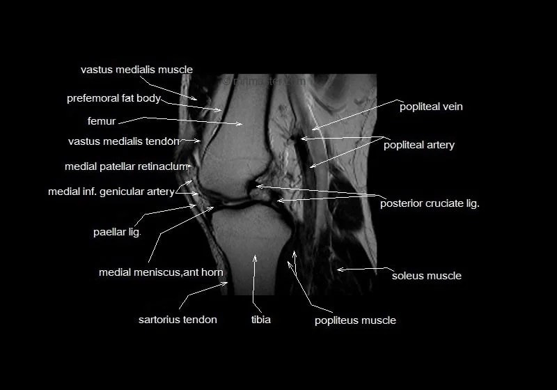 mri knee anatomy knee sagittal anatomy free cross sectional anatomy