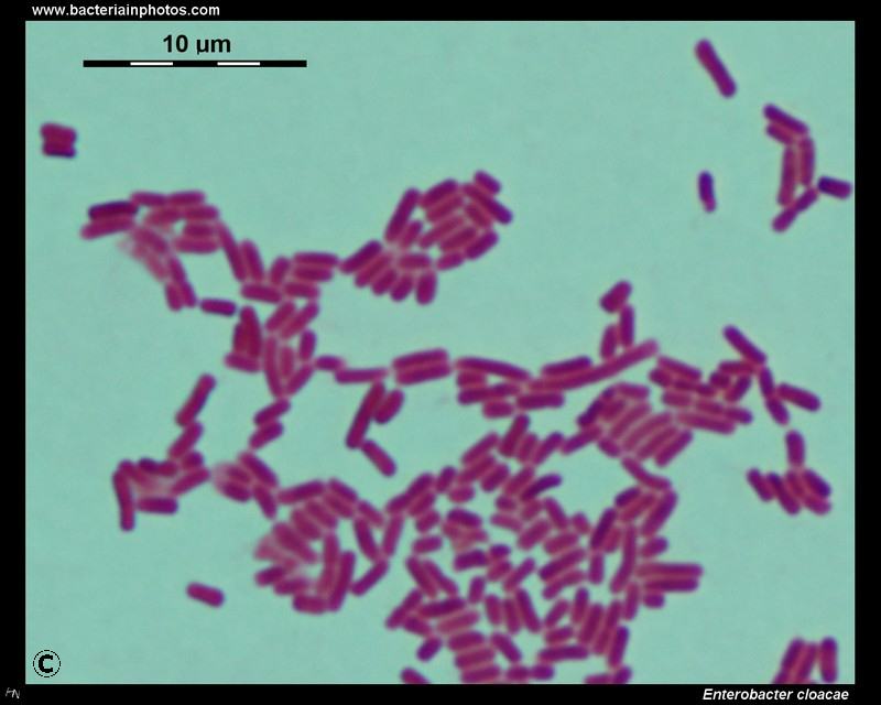 Enterobacter Species